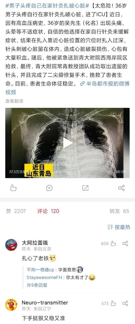 男子头疼自己在家针灸扎破心脏-社会新鲜事社区-休闲娱乐-微看VCAN